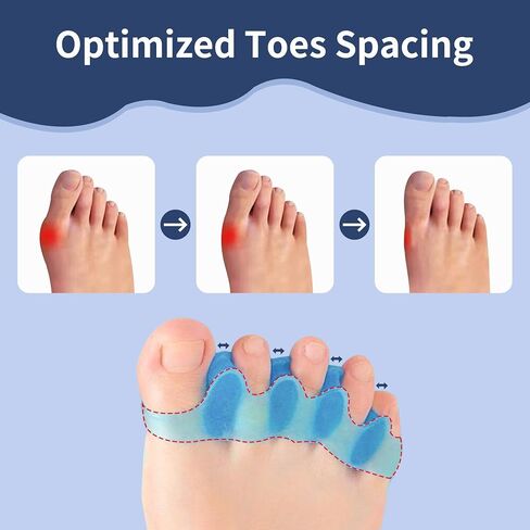Toe Separators for Women/Men (4 PCS), Soft Toe Spacers Bunion Corrector for Women/Men, Gel Toe Spacers for Foot Pain Relief (Pink/Blue), Universal Size in Kuwait