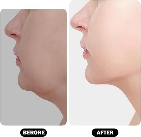 Jawline تمرين الفك من السيليكون للرجال والنساء 3 مستويات مقاومة Jawline Trainer BPA مجاني مزدوج الذقن تمرين الفك تونر الوجه تمرين الفك تمرين الفم لخط الفك in Saudi Arabia