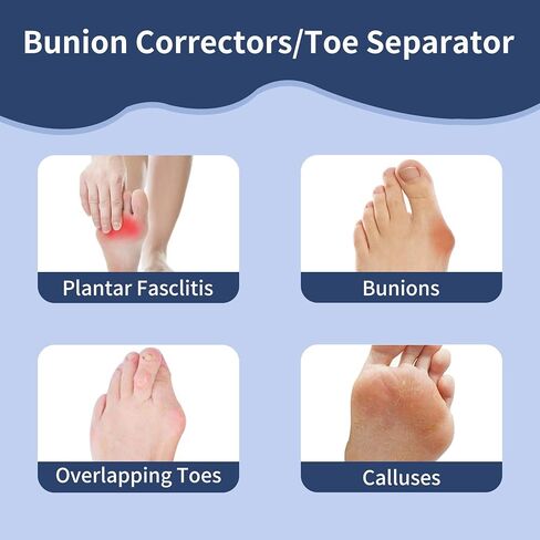 Toe Separators for Women/Men (4 PCS), Soft Toe Spacers Bunion Corrector for Women/Men, Gel Toe Spacers for Foot Pain Relief (Black/White), Universal Size in Kuwait