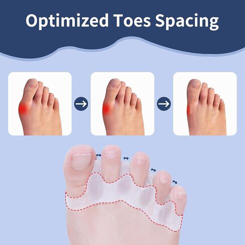 Toe Separators for Women/Men (4 PCS), Soft Toe Spacers Bunion Corrector for Women/Men, Gel Toe Spacers for Foot Pain Relief (Black/White), Universal Size in Kuwait