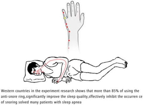 Anti-Snoring Ring, 3sizes Anti Snoring Ring Snoring Antiper Snoring, Sleep Breathing snoring, Improve Breathing, Anti Snore & Sleeping Breath Acupressure Massage Anti Snore Device[L] in Saudi Arabia
