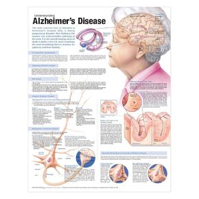 Understanding Alzheimer's Disease Anatomical Chart