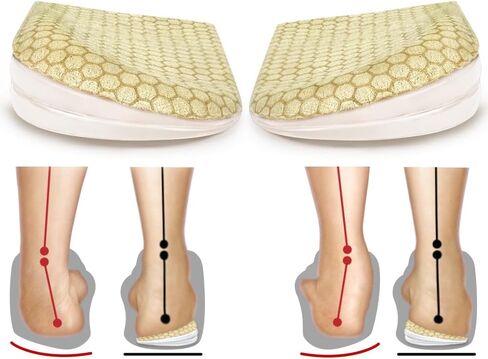 Corrective Insoles for Supination & Over-Pronation, Orthotics Medial & Lateral Heel Wedge Inserts for Foot Alignment, Bow Legs, Knee Pain (Black-2 Layers, L: Women 8-12/Men: 7.5-13) in Saudi Arabia