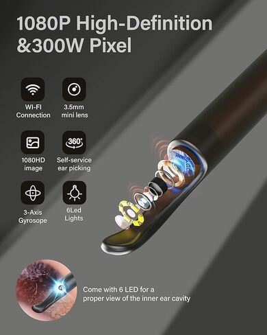 منظف ​​الأذن من BEBIRD مع الكاميرا - منظار الأذن اللاسلكي مع كاميرا HD 1080P ومصابيح LED لإزالة شمع الأذن - أداة إزالة شمع الأذن المرئية مع الصور ومقاطع الفيديو عبر تطبيق BEBIRD المجاني in Kuwait