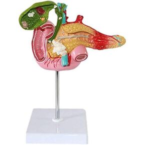 Human Pancreatic Duodenum Gallbladder Pathological Anatomy Model, Life Size Medical Education Digestive System Anatomical Teaching Models