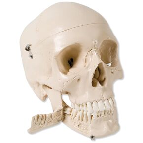 3B Scientific W10532 4 Part Skull Model with Teeth for Extraction, 8.7" x 5.3" x 6.7"