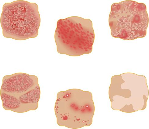 Natural Skin Spray - Travel-Friendly 3.38 Ounce Spray (Pack of 4) in Kuwait