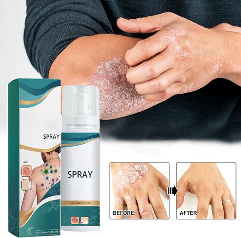 Natural Skin Spray - Travel-Friendly 3.38 Ounce Spray (Pack of 4) in Kuwait