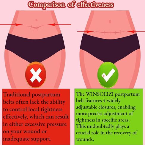Postpartum Belly Band – Skin-Friendly Fabric & Adjustable Belly Band, Suitable for Vaginal & Cesarean Deliveries, Abdominal Binder-Postpartum Essentials (Nude,L) in Saudi Arabia
