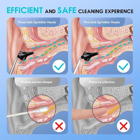 Ear Wax Removal Tool, Water Powered Ear Cleaner with 9 Pressure Settings, 6 Reusable 3 & 5 Hole Tips, IPX7 Waterproof Ear Cleaning Kit Safe and Effective to Clean Build-up Earwax (White) in Saudi Arabia