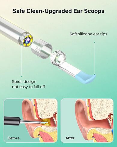 Ear Wax Removal in Kuwait