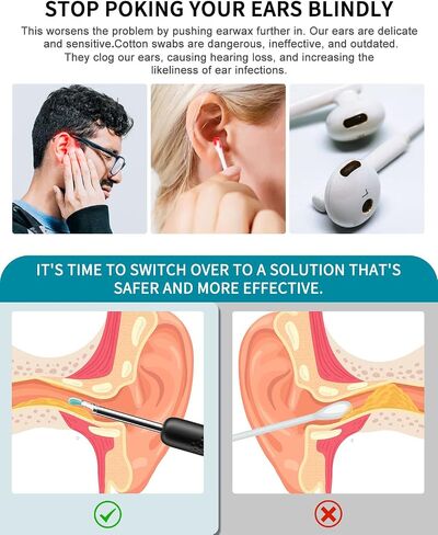 Ear Wax Removal Kit, Ear Cleaner with 1080P FHD Otoscope & 6 LED Lights, Wireless Ear Camera with 8pcs Accessories for Multifunctions in Saudi Arabia