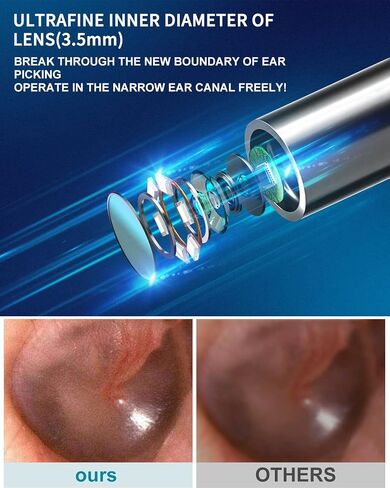 Ear Wax Removal Kit, Ear Cleaner with 1080P FHD Otoscope & 6 LED Lights, Wireless Ear Camera with 8pcs Accessories for Multifunctions in Saudi Arabia