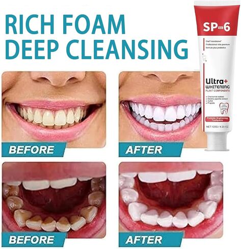 Sp-6 Ultra Toothpaste, Sp 6 Toothpaste 2pcs,probiotics toothpaste,Deep Cleaning Care Toothpaste,Fresh Breath Toothpaste 120g (2 sticks) in Saudi Arabia