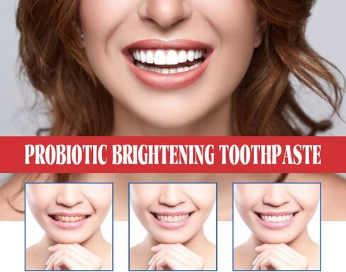 Sp-6 Ultra Toothpaste, Sp 6 Toothpaste 2pcs,probiotics toothpaste,Deep Cleaning Care Toothpaste,Fresh Breath Toothpaste 120g (2 sticks) in Saudi Arabia