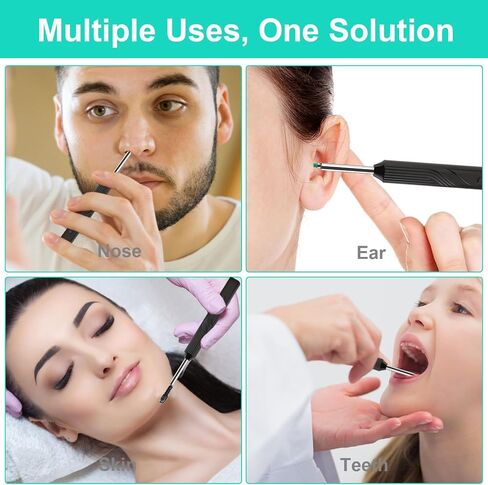 Ear Wax Removal Tool Camera - Earwax Remover Tool with HD Camera and 6 LED Lights,Wireless Ear Cleaner with 6PCS Ear Set,Otoscope Ear Wax Removal Kit for iPhone,Android Smart Phones (Black) in Saudi Arabia