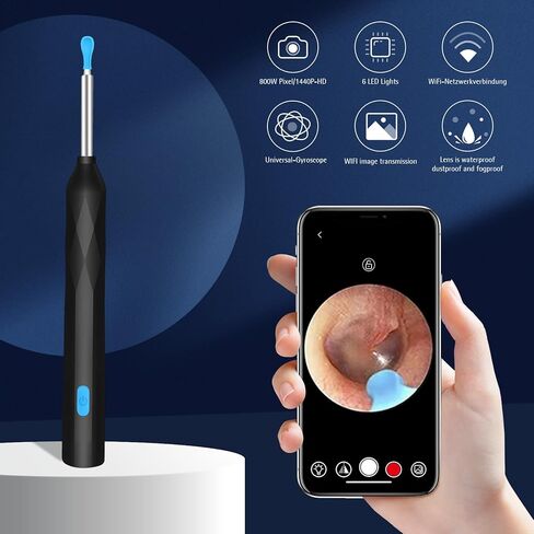 Ear Wax Removal, Ear Wax Removal Tool Camera with 1440P, Ear Cleaner with Camera and 7 Pcs Ear Set, Earwax Removal Kit with 6 Led Lights for iPhone, IPad, Android Phones (Black) in Saudi Arabia