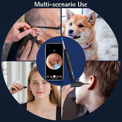 Ear Wax Removal, Ear Wax Removal Tool Camera with 1440P, Ear Cleaner with Camera and 7 Pcs Ear Set, Earwax Removal Kit with 6 Led Lights for iPhone, IPad, Android Phones (Black) in Saudi Arabia