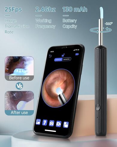إزالة شمع كاميرا الأذن، أداة تنظيف الأذن بدقة 1080 بكسل عالية الدقة مع كاميرا ومنظار الأذن مع ضوء، منتقي الأذن مع كاميرا 8 قطع مجموعة إزالة شمع الأذن المحمولة لملعقة الأذن ومنظف كاميرا الأذن لهاتف iPhone وAndroid in Kuwait