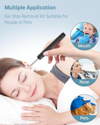 إزالة شمع كاميرا الأذن، أداة تنظيف الأذن بدقة 1080 بكسل عالية الدقة مع كاميرا ومنظار الأذن مع ضوء، منتقي الأذن مع كاميرا 8 قطع مجموعة إزالة شمع الأذن المحمولة لملعقة الأذن ومنظف كاميرا الأذن لهاتف iPhone وAndroid in Kuwait