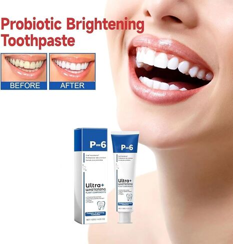 Sp-6 Ultra Whitening، Sp 6 معجون أسنان، معجون أسنان فائق التبييض Sp - 6، معجون أسنان بروبيوتيك لتفتيح الأسنان، معجون أسنان للعناية بالتنظيف العميق، نفس منعش ((عبوة من قطعة واحدة) أزرق) in Kuwait