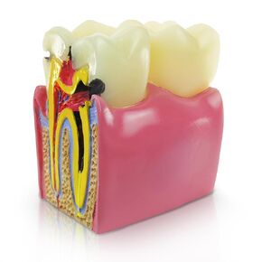 Tooth Caries Development Model, Dental Anatomy Research and Oral Care Teaching for Doctors and Patients, The Whole Process of Dental Evolution