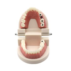 Dentist Caries Model for Teaching Decay Tooth Model Teeth Care Dental StudyModel