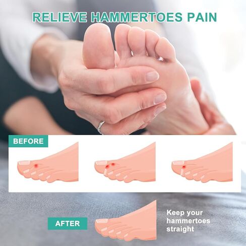 أداة فرد إصبع القدم المطرقة، مصحح إصبع القدم المطرقة للنساء، جبيرة إصبع القدم لأصابع القدم المكسورة، وأصابع القدم الملتفة، مقاس SML in Kuwait