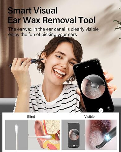 أداة إزالة شمع الأذن، منظف الأذن من بيبيرد مع كاميرا أذن 1080 بكسل، طقم تنظيف الأذن مع 8 قطع من مجارف الأذن المصنوعة من السيليكون الناعم، مزيل شمع الأذن مع ضوء، صندوق تخزين، منظف الأذن لأجهزة iPhone وiPad وAndroid in Kuwait
