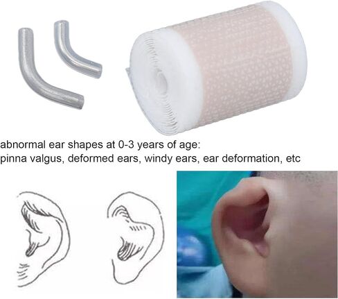Aesthetic Corrector for Protruding Ear Newborn Ear Aesthetic Corrector Corrector for Protruding Ear Baby Ear Corrector Auricle Silicone Correction Patch Skin Friendly Comfortable Baby Gel Ear Tape in Saudi Arabia
