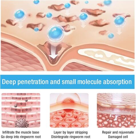 كريم الصدفية - أقصى قوة 4% كريم تخفيف الصدفية بحمض الساليسيليك، كريم التهاب الجلد الدهني، الطفح الجلدي، مضاد للحكة، الاحمرار، التقشر، التقشر، تخفيف سريع المفعول للتهيج - 3.4 أونصة in Kuwait