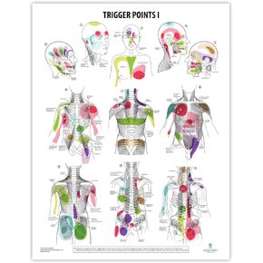Anatomy Lab Trigger Points I Poster, LAMINATED, Anatomy and Physiology Trigger Points Poster, 17.3 x 22.5 Inches, Trigger Points Anatomy Poster