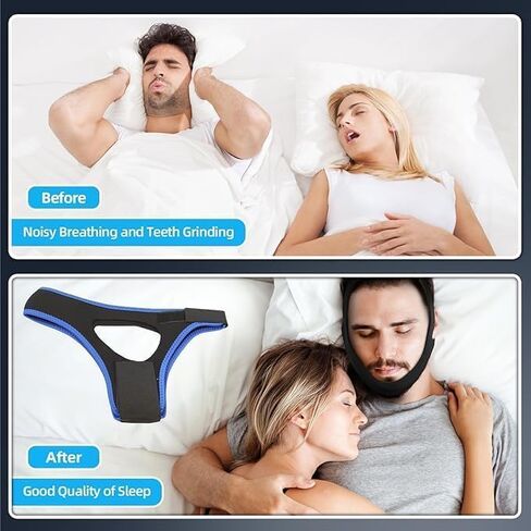 Anti Snore Chin Strap, Adjustable Chin Strap for Snoring, Effective Stop Snoring Solution for Sleep Chin Strap, Breathable Snore Reducing Snoring Solution for Men and Women, Universal Size in Saudi Arabia