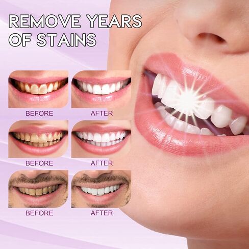 قطعتان من معجون الأسنان الأرجواني، معجون أسنان مصحح اللون لتبييض الأسنان، معجون أسنان رغوي لتبييض الأسنان وإزالة البقع الصفراء للأسنان الحساسة مناسب للسفر in Kuwait