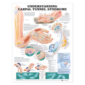 Understanding Carpal Tunnel Syndrome Anatomical Chart