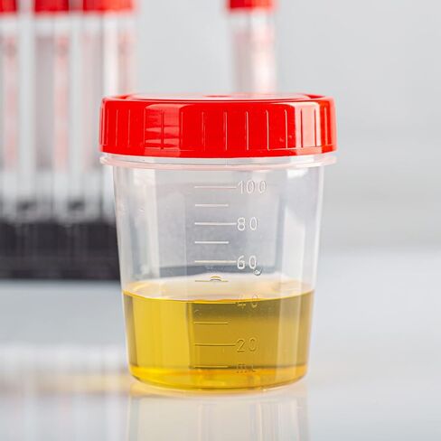 PATIKIL 50mL Sample Cups, 5 Pack Sample Containers Leak Proof Screw Cap for Lab Home, Red in Saudi Arabia