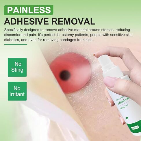 Adhesive Remover Spray 1 Oz, Skin-Friendly No Sting Ideal for Ostomy Patients, Sensitive Skin, Bandage Removal, Tape, Gum in Hair, Glitter, Wig Adhesives, 2 PCS in Kuwait