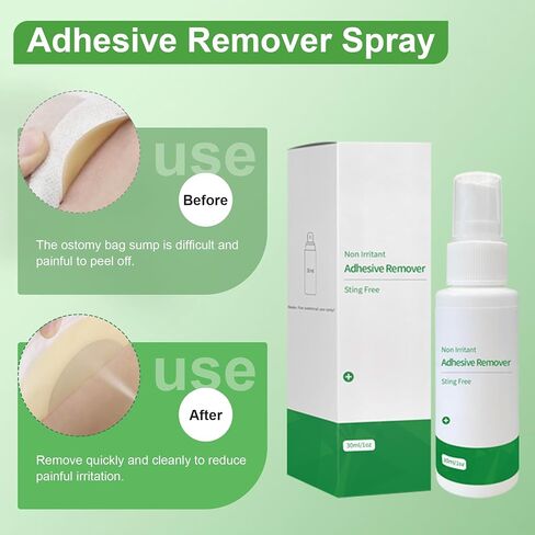 Adhesive Remover Spray 1 Oz, Skin-Friendly No Sting Ideal for Ostomy Patients, Sensitive Skin, Bandage Removal, Tape, Gum in Hair, Glitter, Wig Adhesives, 2 PCS in Kuwait