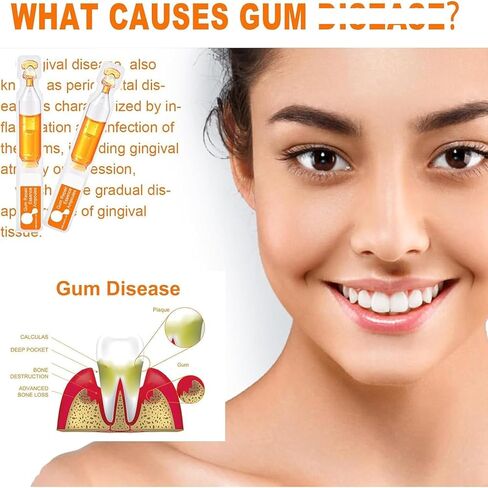 (صندوقان) أمبولات جوهر اللثة، أمبولات انحسار اللثة، إعادة نمو اللثة لانحسار اللثة، علاج اللثة لانحسار اللثة in Kuwait