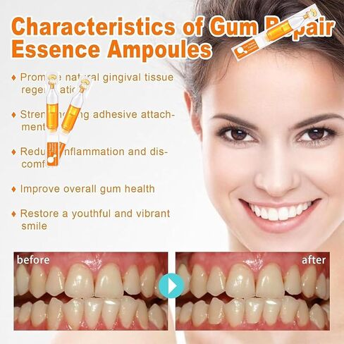 (صندوقان) أمبولات جوهر اللثة، أمبولات انحسار اللثة، إعادة نمو اللثة لانحسار اللثة، علاج اللثة لانحسار اللثة in Kuwait