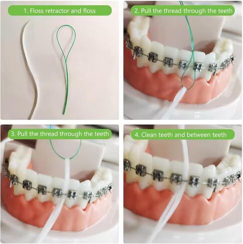 70 Count Dental Floss Threaders for Braces, Bridges, and Implants, Orthodontic Floss Needle Threaders, Traction Device for Teeth Correction, Dental Cleaning Care Accessories in Saudi Arabia