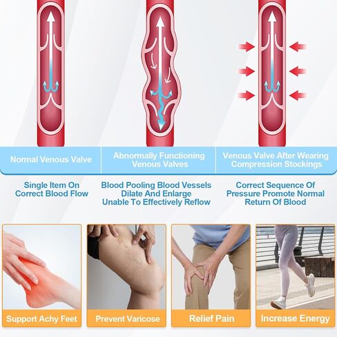 2Pairs Ted Hose Compression Stockings for Women and Men, Anti Embolism Compression Stockings, Surgical Compression Stocking, 15-20 mmHg Compression TED Hose with Inspect Toe Hole in Saudi Arabia