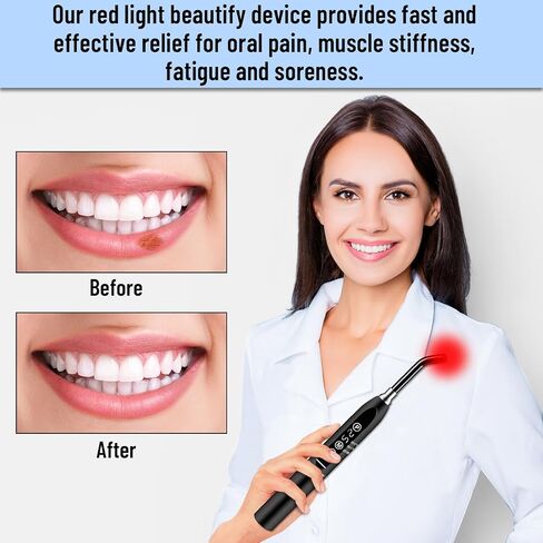 Red Light Beautify Cold Sores Device, Canker Cold Sore Near Infrared Red Light Beautify for Lips Mouth Nose Ear Hands Joint Muscle Pain Relief with Removable Tip (Black) in Saudi Arabia