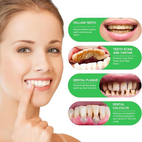 سحب الزيت بزيت جوز الهند والنعناع - تبييض الأسنان الطبيعي ورائحة الفم الكريهة المنعشة، غسول الفم بالزيوت العطرية العضوية مع مكشطة اللسان الخالية من الكحول، علاج للثة - 8 أونصة سائلة in Kuwait