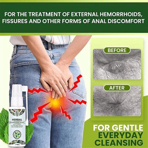 Herbal Hemorrhoids Spray, 3-Pack Hemorrhoids Spray, White in Saudi Arabia
