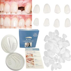 Fake Tooth Repair Kits for Filling The Missing Broken Tooth and Gaps-Moldable Fake Teeth and Thermal Beads Replacement Kits
