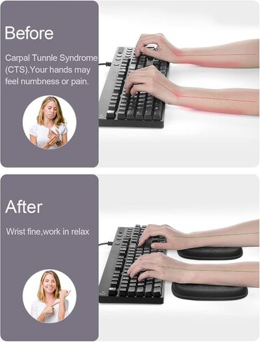 Vaydeer Cloud Elbow Pad, Desk Arm Rest Support, Soft Memory Foam Wrist Rest, Ergonomic Cushion Padding, Carpal Tunnel Pain Relief Gel Mouse Pillow for Computer Laptop Office Gaming Car Chair Accessory in Saudi Arabia