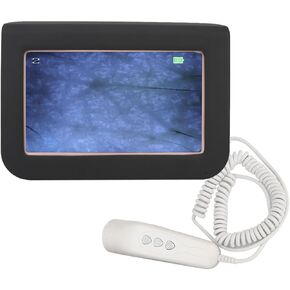 Skin Diagnosis Hair Analyzer, 50X 200X HD Skin Hair Scalp Detector Analyzer Microscope Skin Care Tool 100-240V(US) in Kuwait