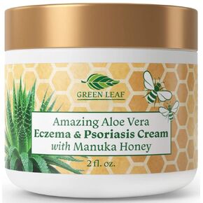 Manuka Honey Eczema Cream (2oz) Moisturizing Lotion Treatment For Psoriasis Relief - Itchy, Dry Skin Rash Healing Ointment - Skin Soothing Moisturizer For Kids, Adults, Baby Ultra Strength Honey Creme For Eczema