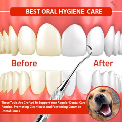 Professional Dental Tartar Scraper Tool - Double Ended Tartar Remover for Teeth, Dental Pick, Plaque Remover, Tooth Scraper - Added Tooth Cleaning at Home - 100% Surgical Stainless Steel-45-10127 (2) in Kuwait